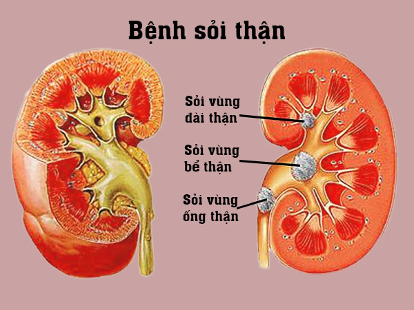 An thận vương